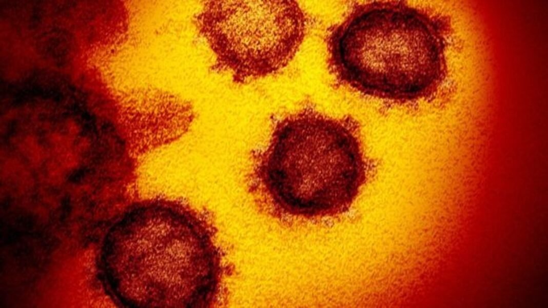 Espigão tem 155 infectados por coronavírus e 04 mortes desde o início da pandemia