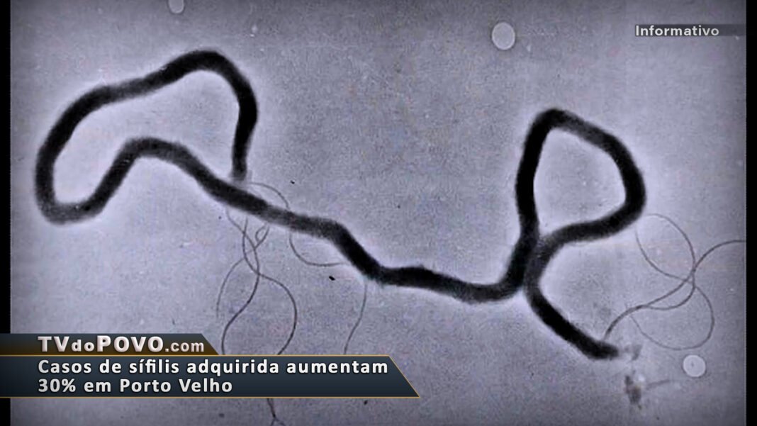 Vídeo: ATENÇÃO – Casos de SÍFILIS adquirida aumentam 30% em Porto Velho