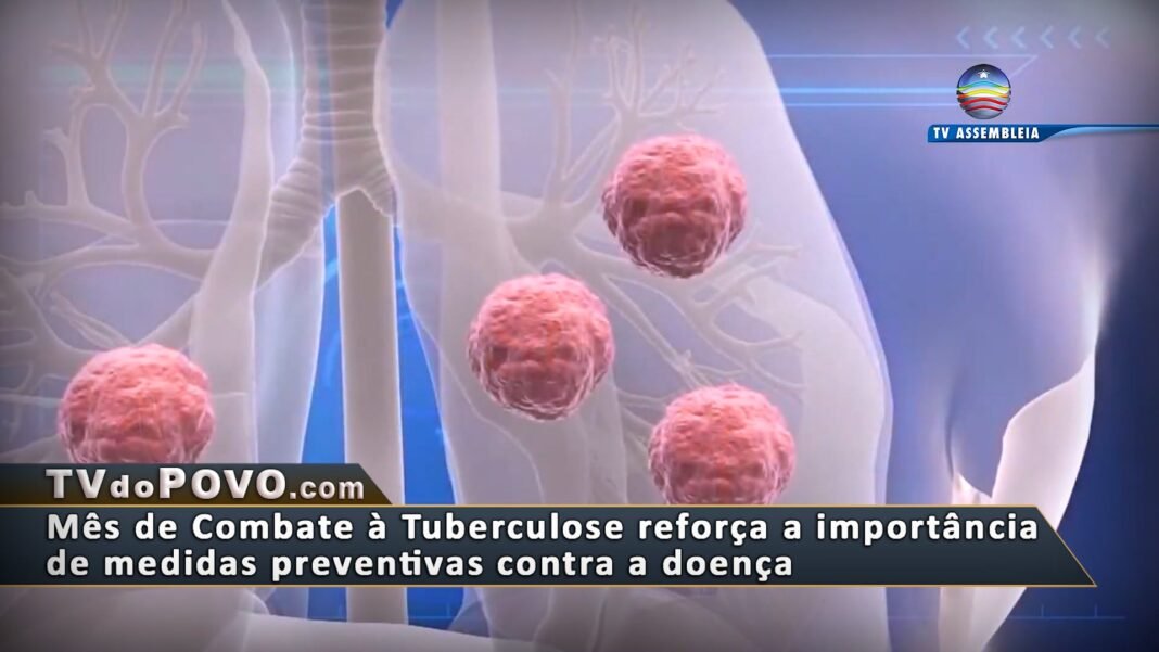 Vídeo: Mês de Combate à Tuberculose reforça a importância de medidas preventivas contra a doença