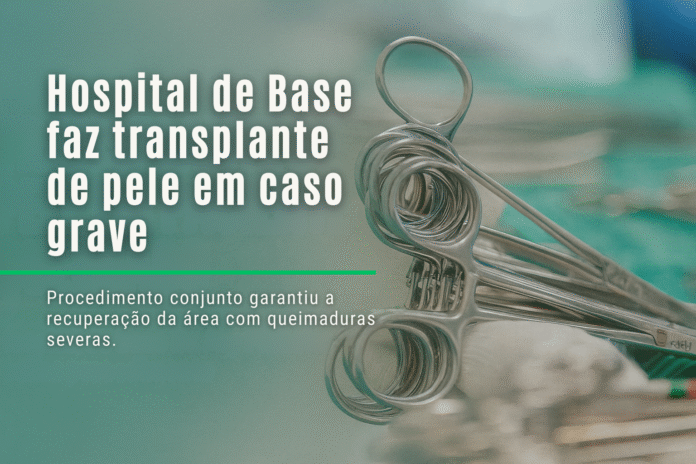Hospital de Base realiza transplante de pele em caso grave Instrumentos cirúrgicos sobre mesa hospitalar usados em transplante de pele no Hospital de Base Dr. Ary Pinheiro.