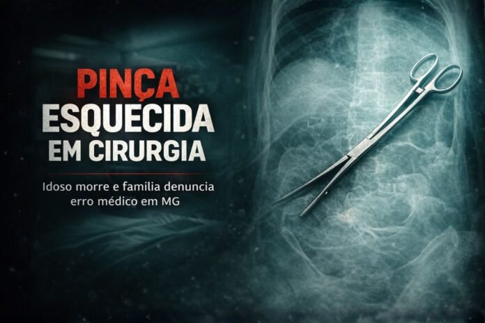 Pinça cirúrgica esquecida em cirurgia após denúncia de erro médico em MG
