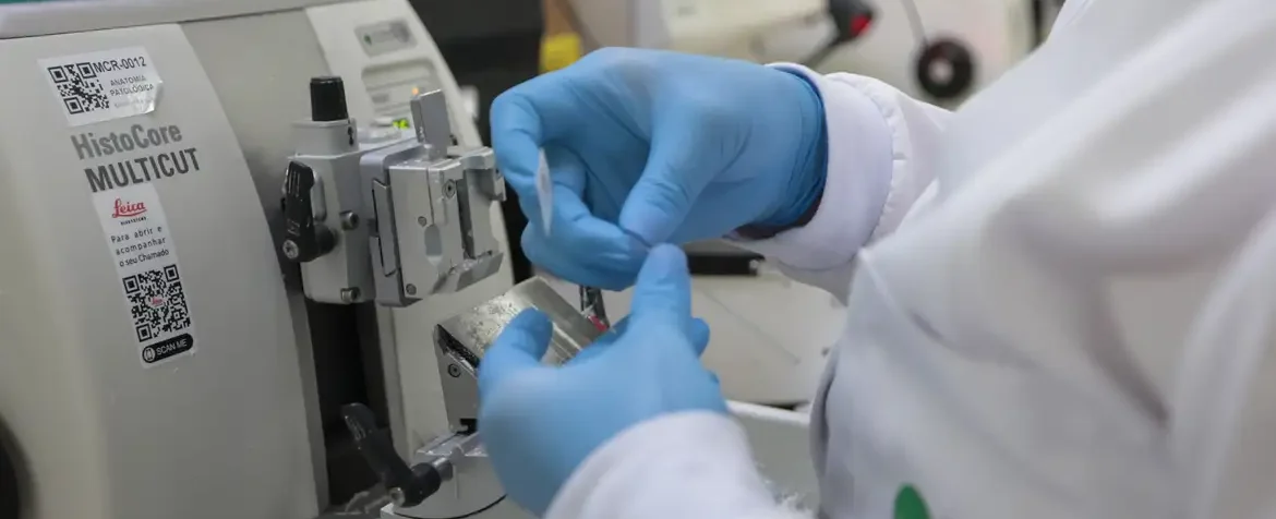 Terapias e vacinas contra o câncer no SUS em laboratório de pesquisa oncológica