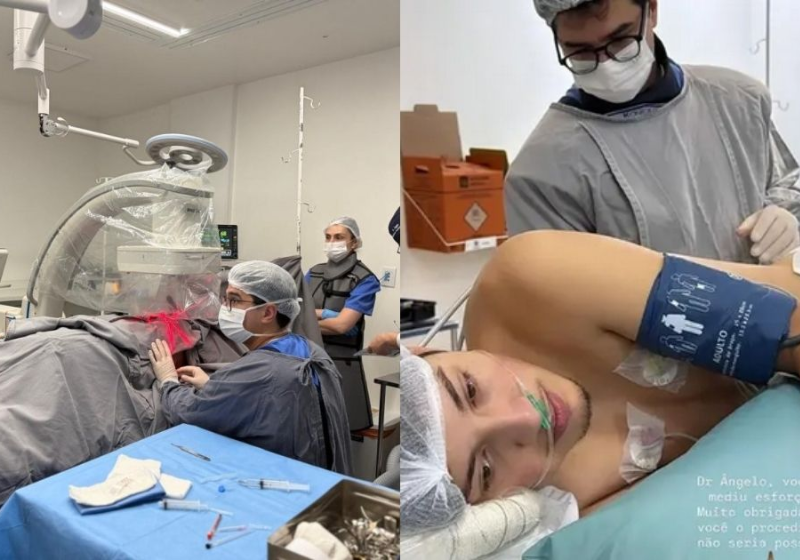 Procedimento com polilaminina em paciente com lesão medular que voltou a mexer os pés