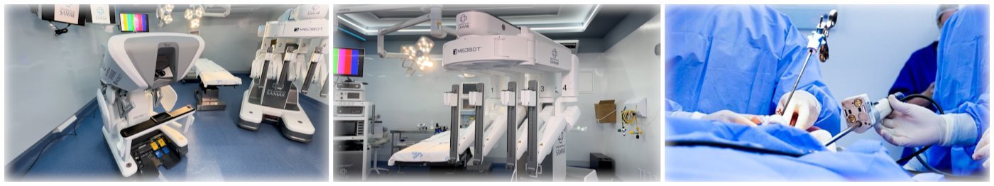 Sala de cirurgia robótica da Rede Hospitalar Samar equipada com plataforma Toumai